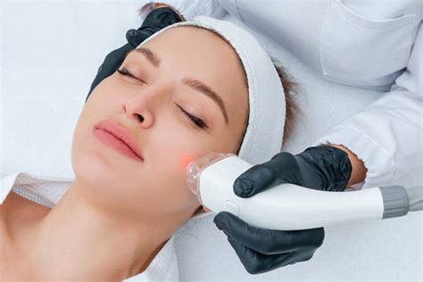 facial hair removal laser treatment